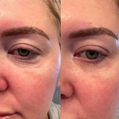 Caffeine De-Puff Eye Roller — Anti-Dark Circle & Wrinkle Serum